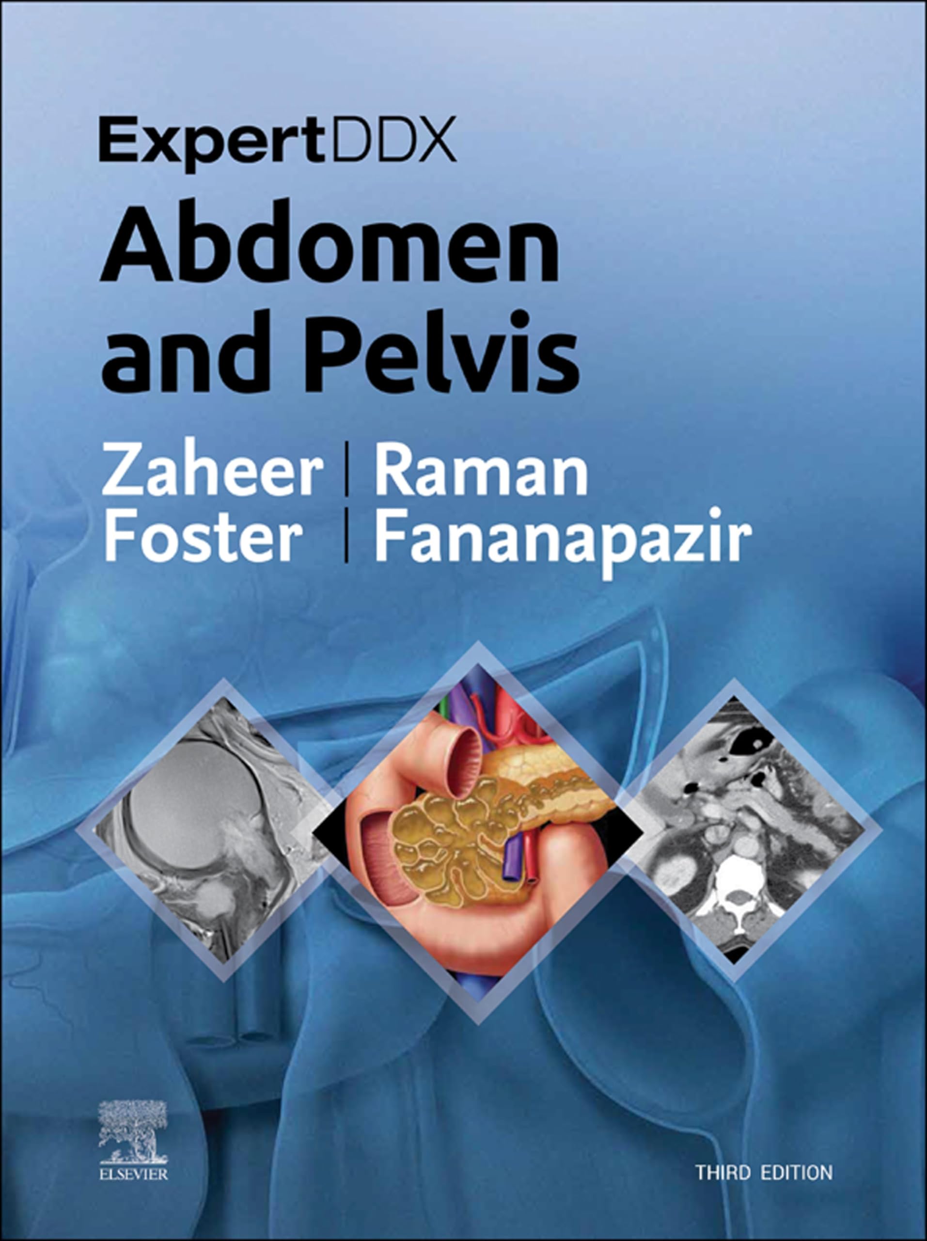 ExpertDDx: Abdomen and Pelvis - 3rd Edition with Audio/Video