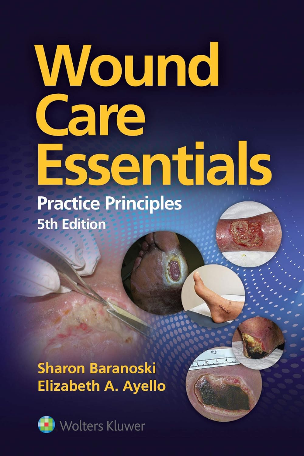 Wound Care Essentials Fifth Edition